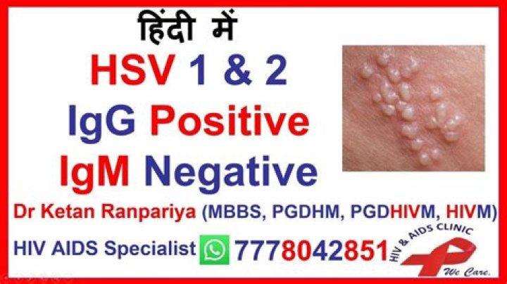 HSV-2 IGG Positive: Understanding the Risks and Implications